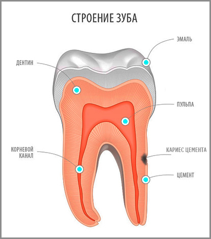 Зуб и начальная стадия кариеса