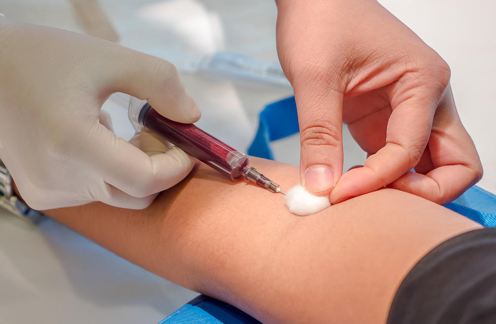 Анализ венозной крови Анализ венозной крови