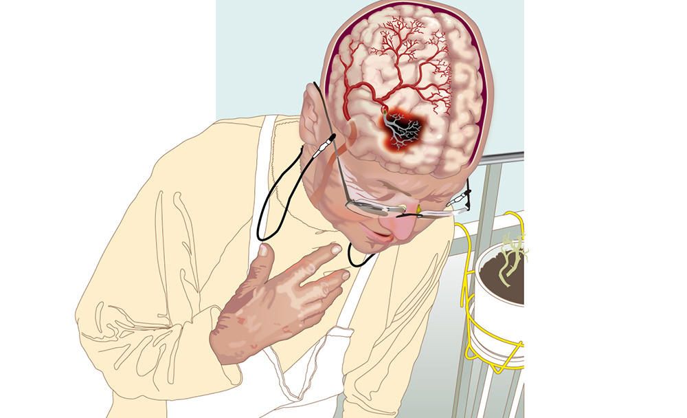 Хроническое течение болезни Хроническое течение болезни