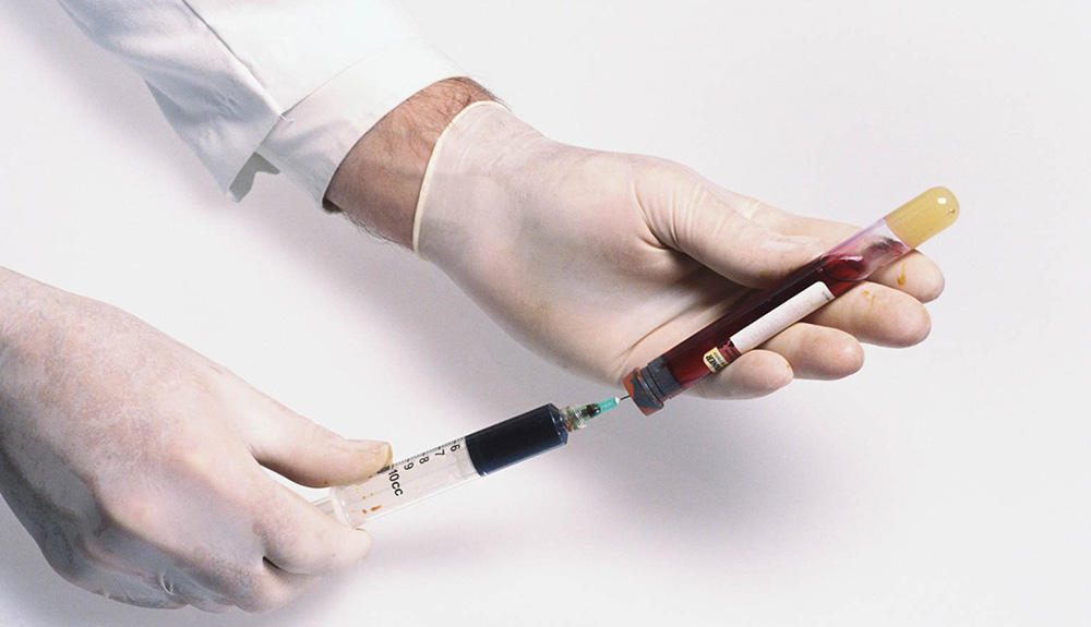 Кто подлежит диагностике RW? Кто подлежит диагностике RW?