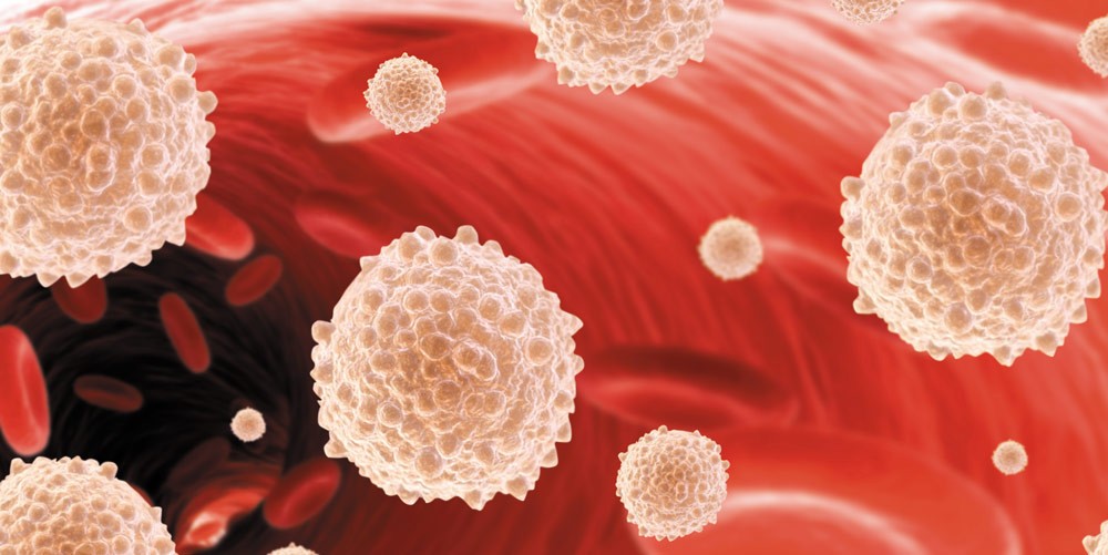 Нейтрофильный лейкоцитоз Нейтрофильный лейкоцитоз