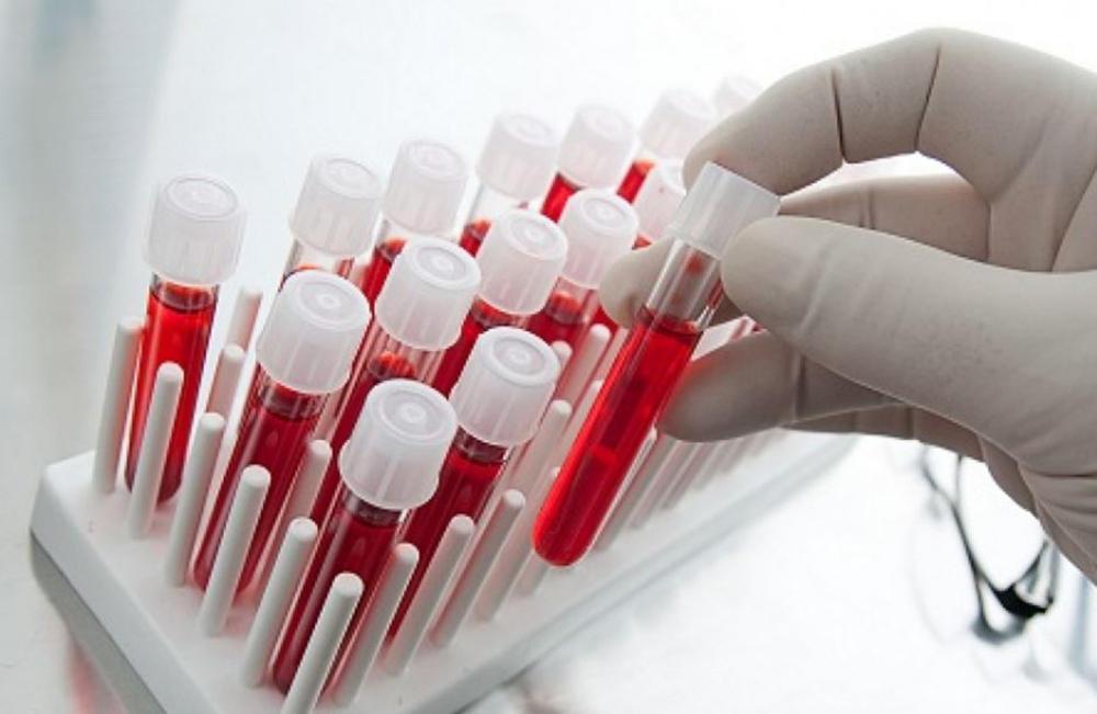 Норма и интерпретация результата Норма и интерпретация результата