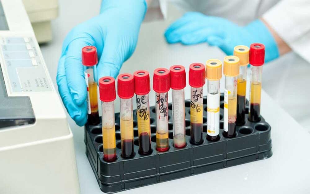 Нормы эритроцитов в крови Нормы эритроцитов в крови