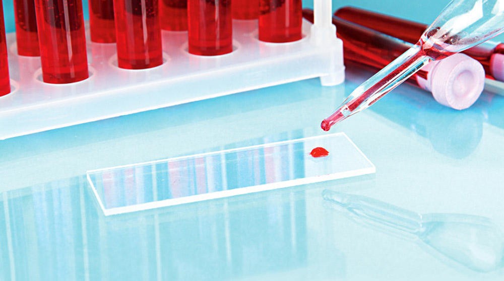 Нормы железа Нормы железа