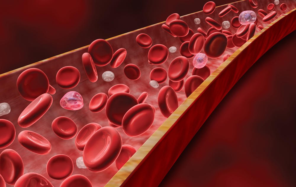 Причины появления Причины появления