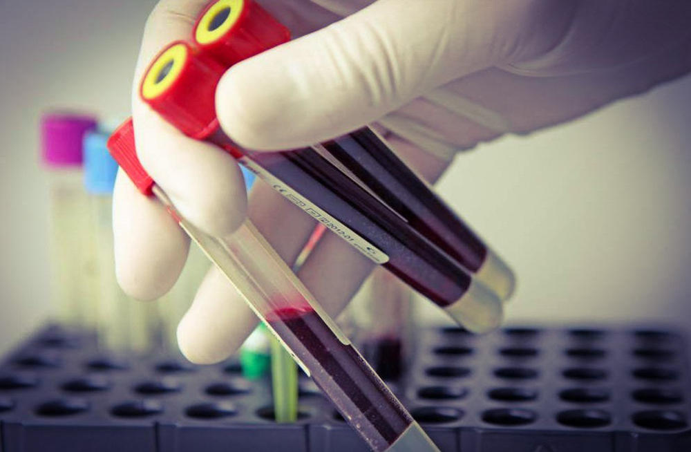 Реактивный белок в крови Реактивный белок в крови