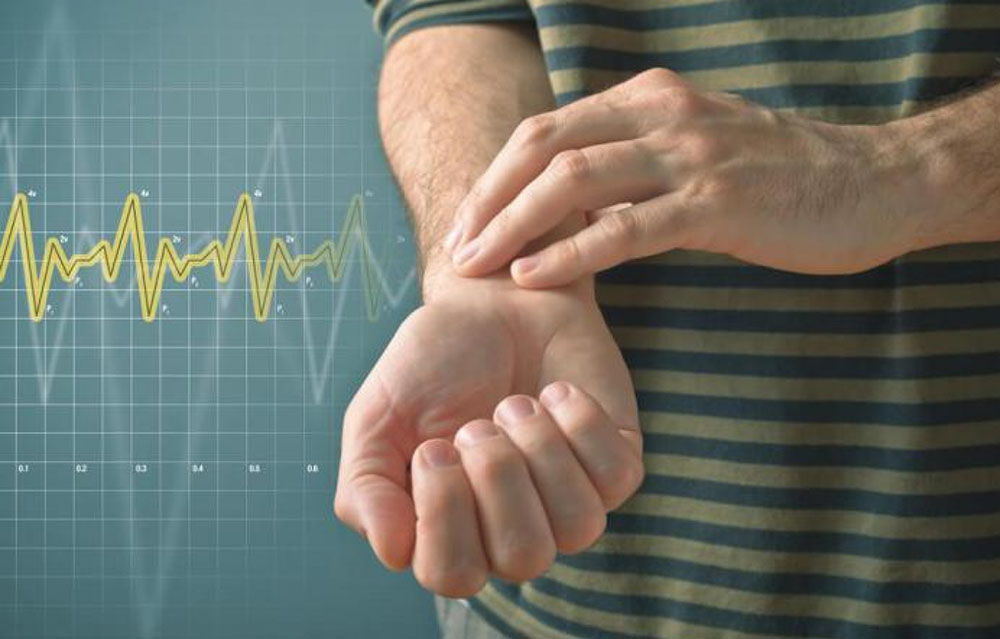 Сбой сердечного ритма Сбой сердечного ритма