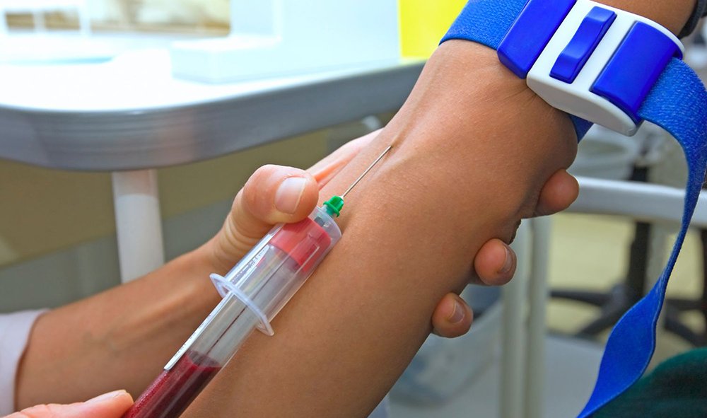 Сдача крови на АСТ Сдача крови на АСТ