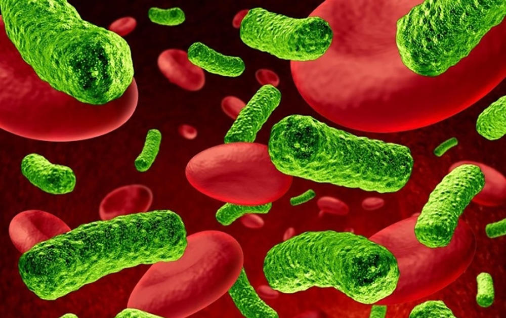 Симптомы сепсиса Симптомы сепсиса