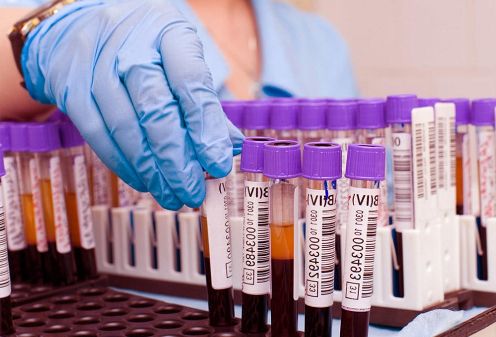 Зачем назначают AST-исследование Зачем назначают AST-исследование