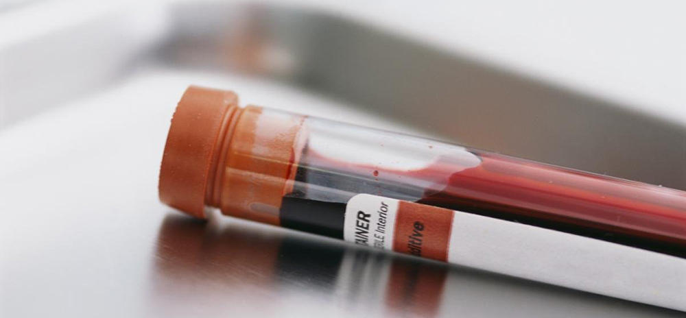 Методология определения уровня глюкозы Методология определения уровня глюкозы