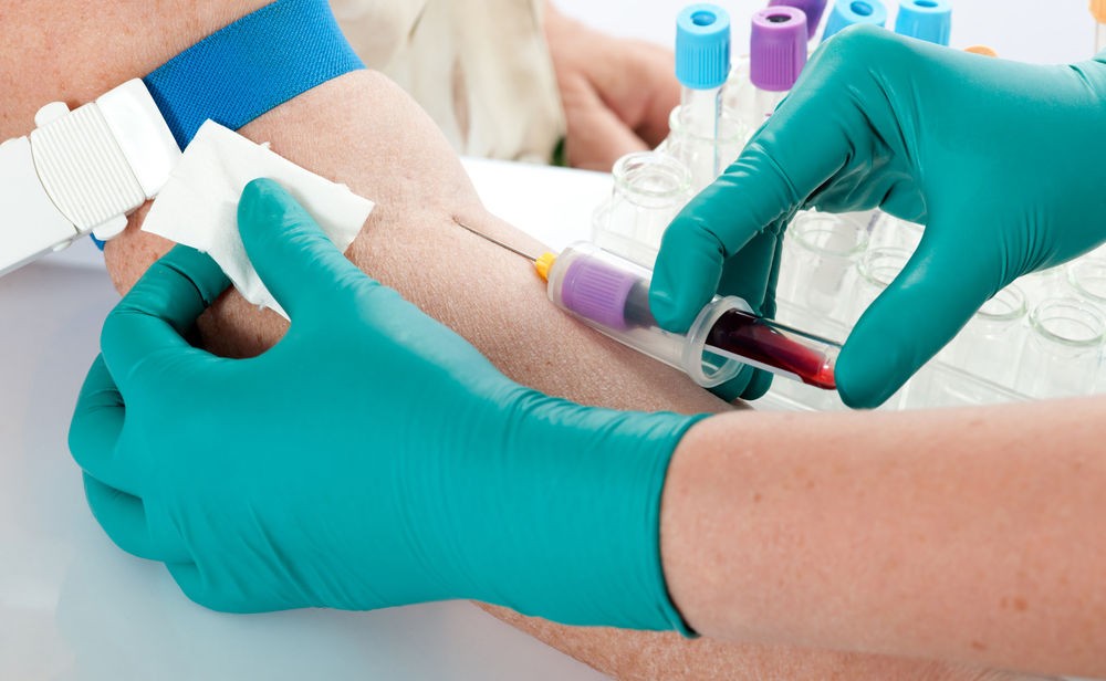 Анализ крови из вены Анализ крови из вены