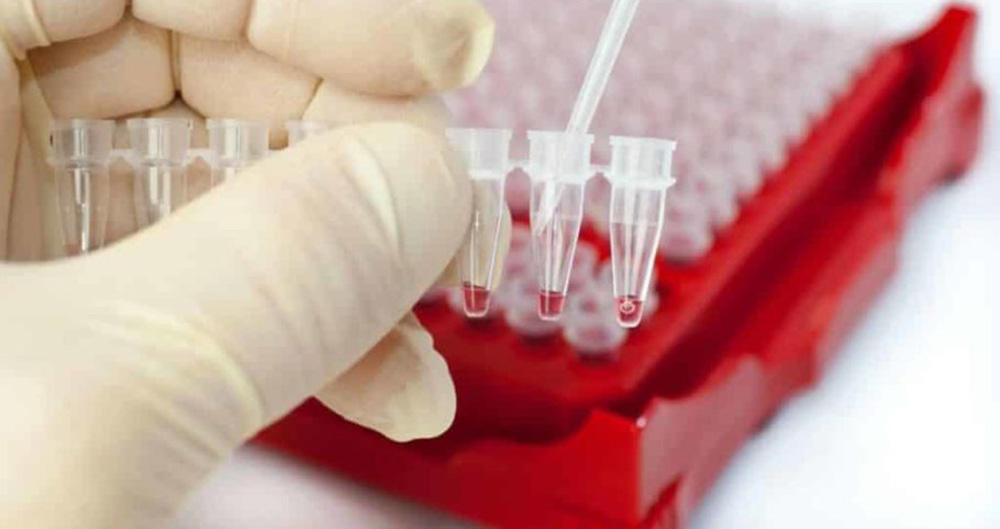 Анализ крови на ПСА Анализ крови на ПСА