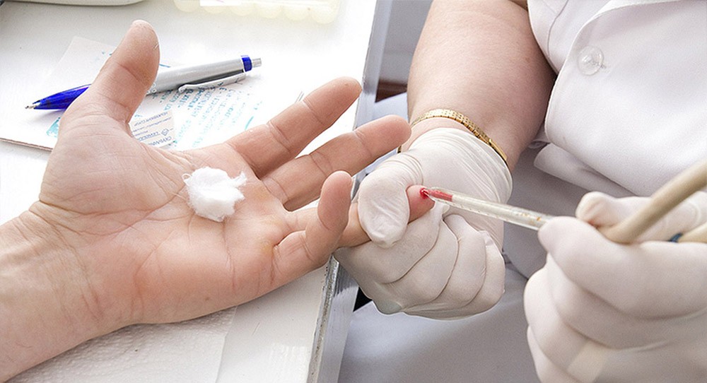 Анализ на HBsAg Анализ на HBsAg