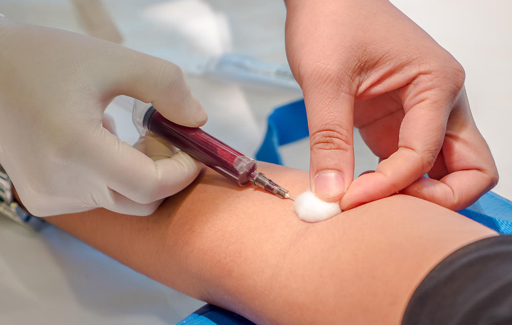 Анализ на кальций Анализ на кальций