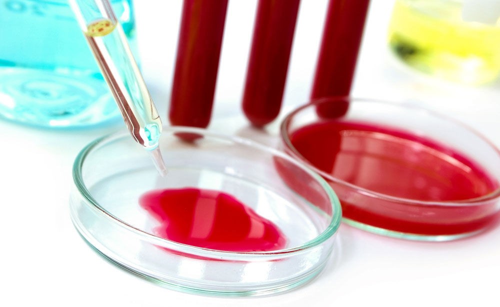 Анализ показателя эритроцитов Анализ показателя эритроцитов