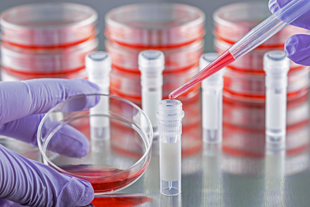 Анализ состояния эритроцитов Анализ состояния эритроцитов