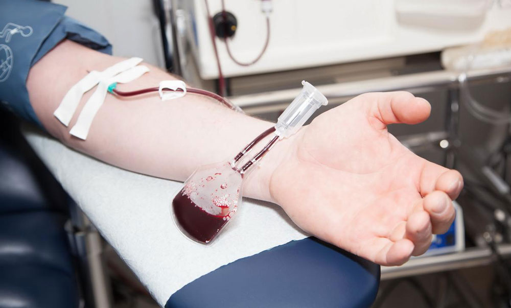 Безаппаратный плазмаферез крови Безаппаратный плазмаферез крови