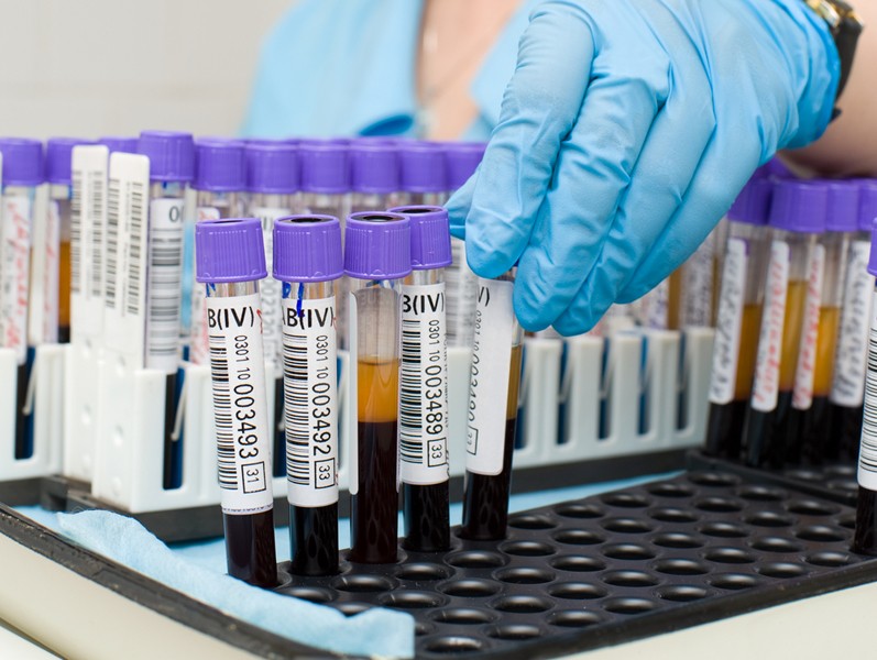 Биохимический анализ крови Биохимический анализ крови