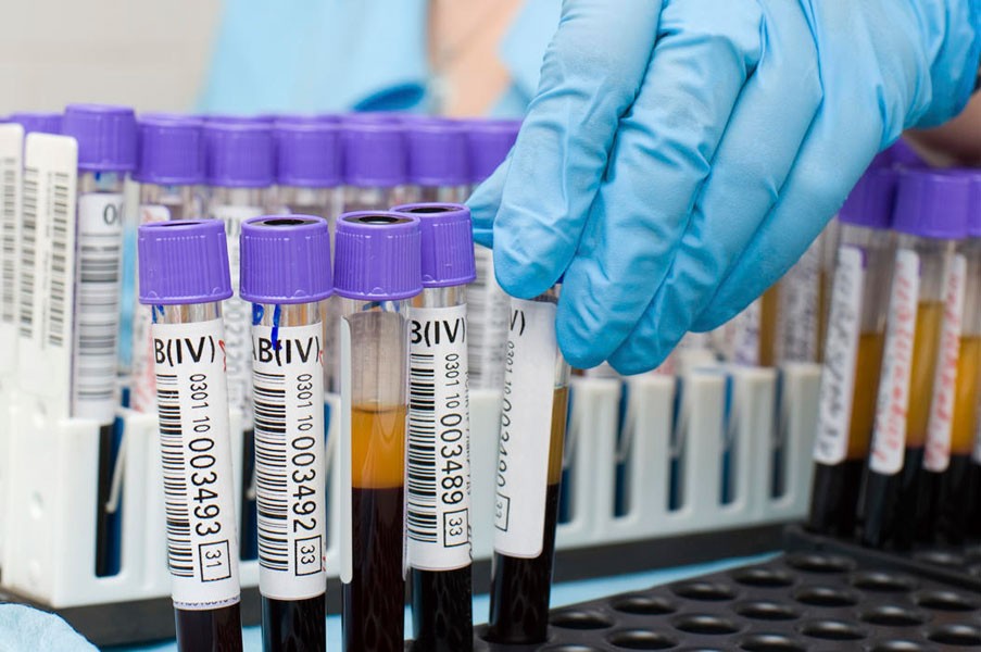 Биохимическое исследование крови Биохимическое исследование крови