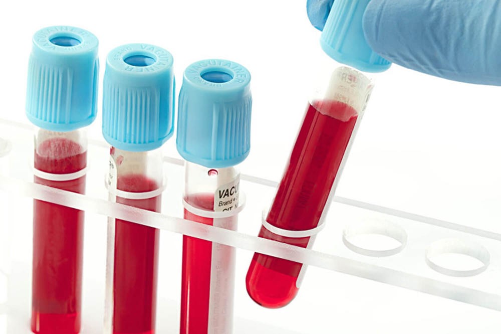 Диагностический анализ крови Диагностический анализ крови