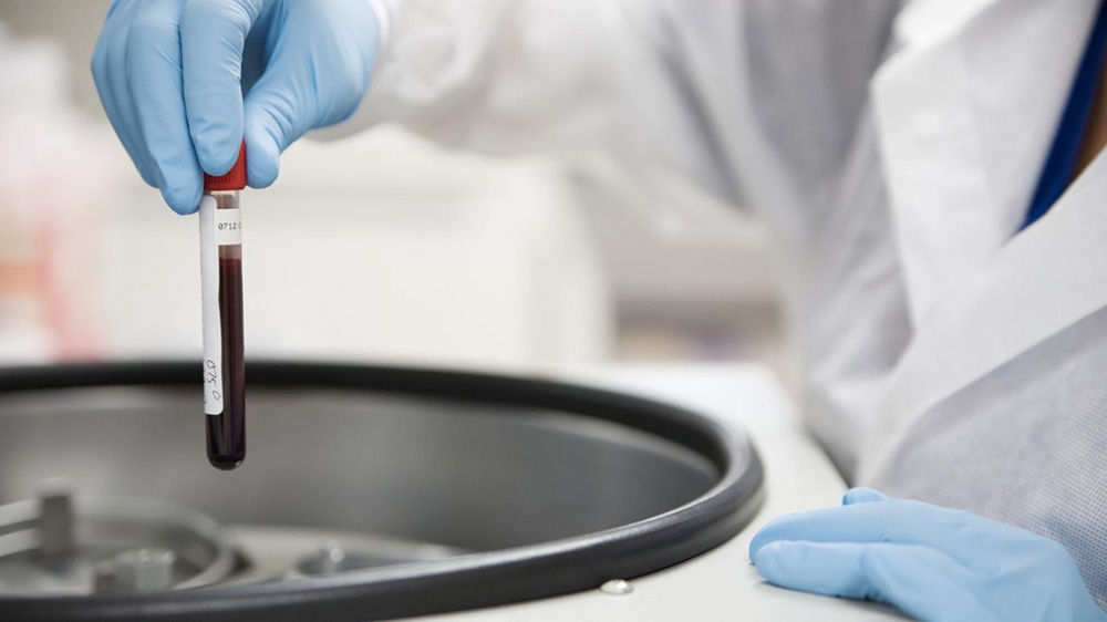 Диагностика белка в крови Диагностика белка в крови