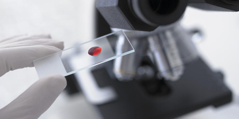 Диагностика заболевания Диагностика заболевания