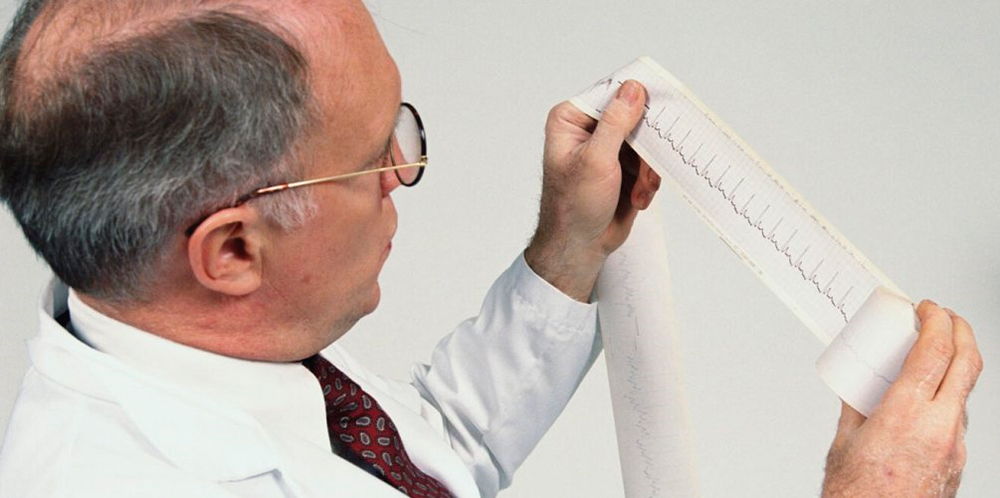 Диагностика стенокардии Диагностика стенокардии