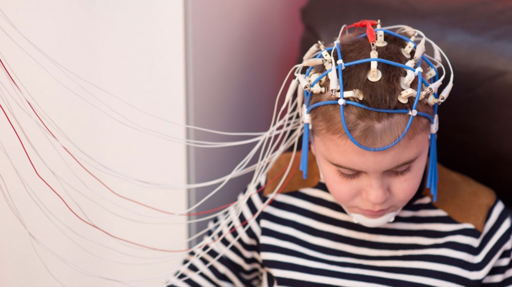 Электроэнцефалограмма как метод диагностики Электроэнцефалограмма как метод диагностики