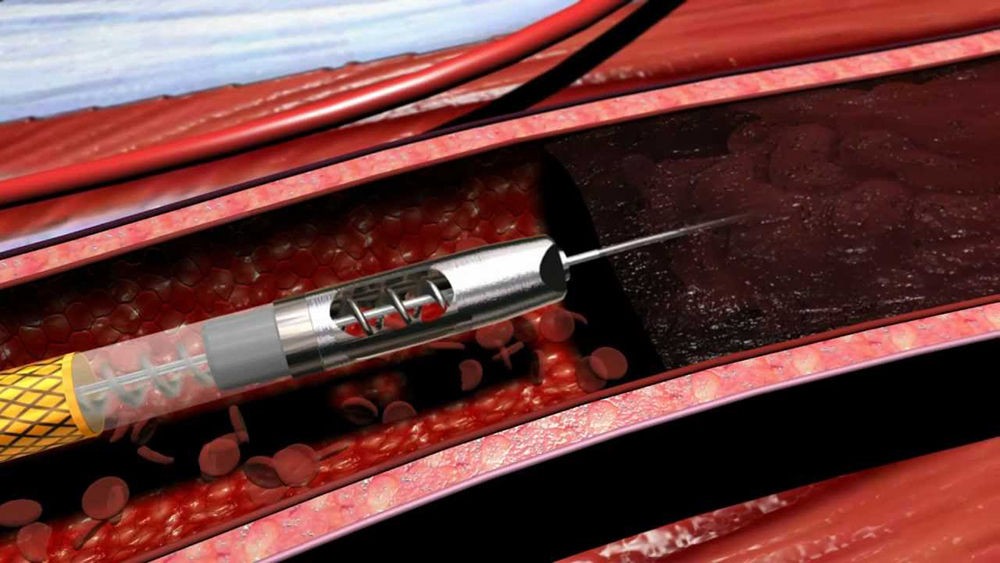 Хирургическое вмешательство Хирургическое вмешательство