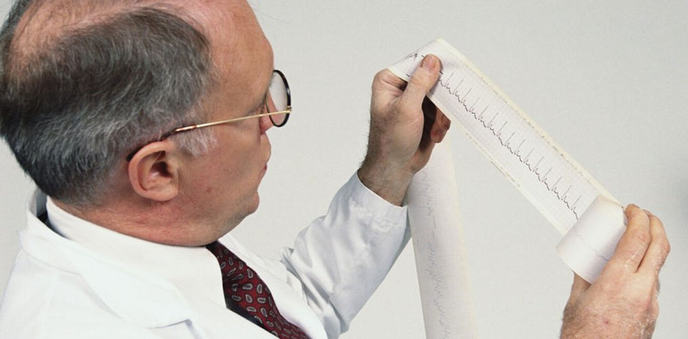 Изучение ЭКГ Изучение ЭКГ