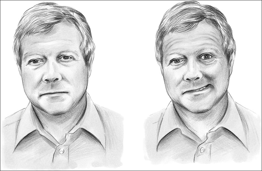 Как распознать инсульт Как распознать инсульт