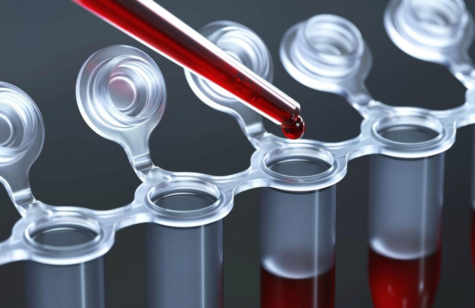 Кислотно-щелочной анализ крови Кислотно-щелочной анализ крови