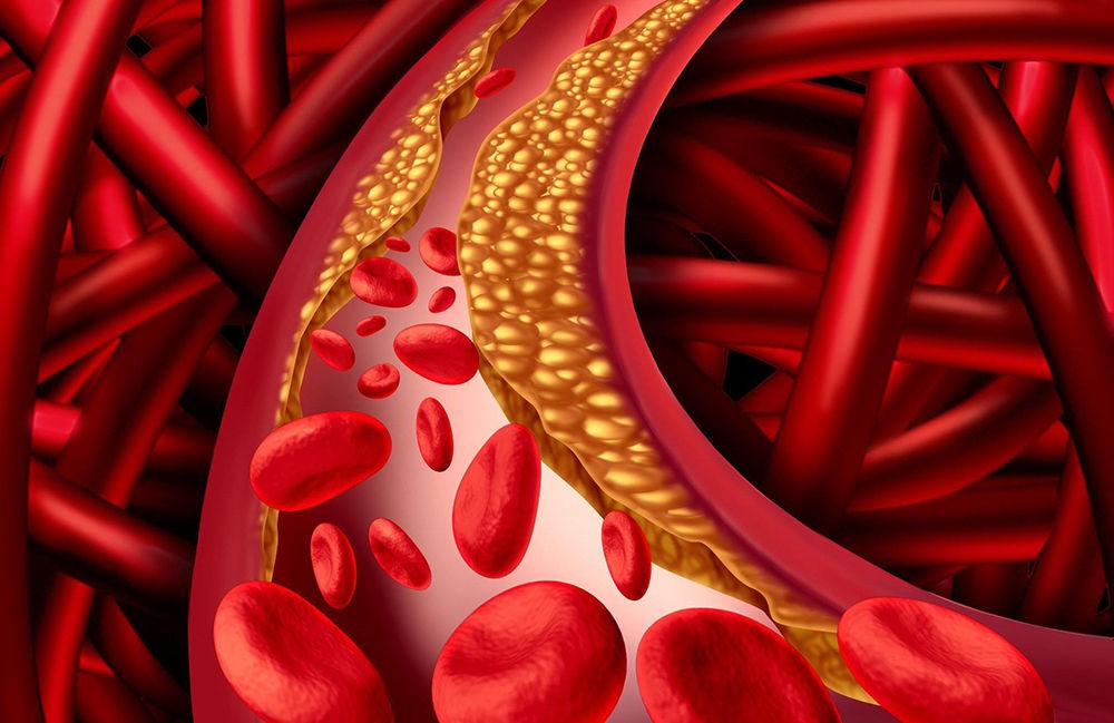 Классификация по Браунвальду Классификация по Браунвальду