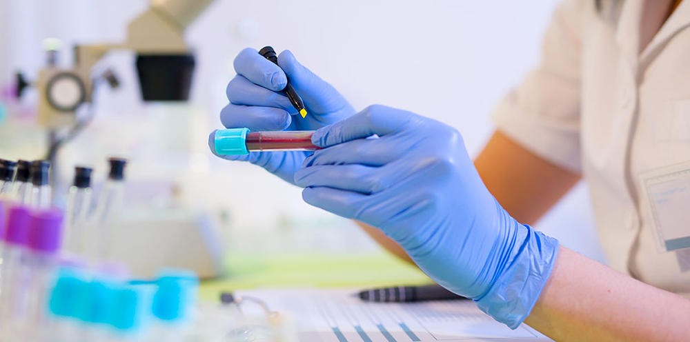 Когда нужен анализ Когда нужен анализ