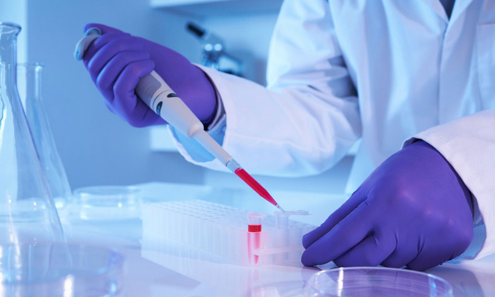 Лабораторные исследования крови Лабораторные исследования крови