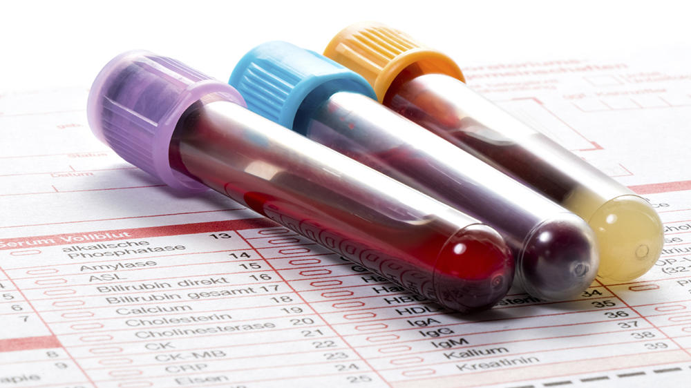 Лабораторная диагностика Лабораторная диагностика