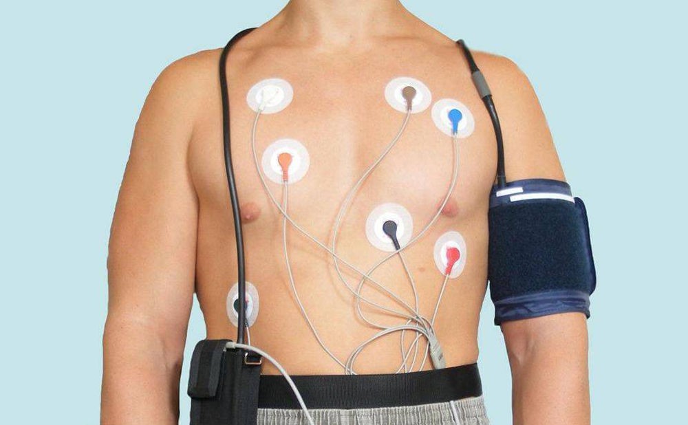 Метод холтеровского мониторинга Метод холтеровского мониторинга