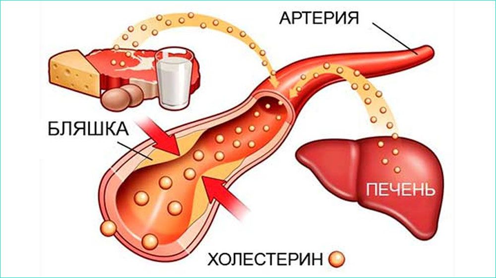 Обмен холестерина Обмен холестерина