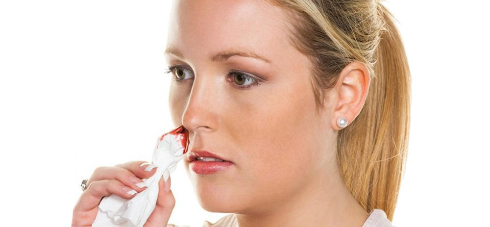 Носовое кровотечение по утрам Носовое кровотечение по утрам