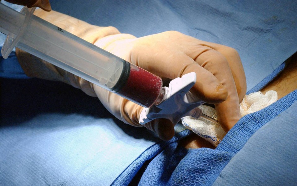 Обследованием пункции костного мозга Обследованием пункции костного мозга