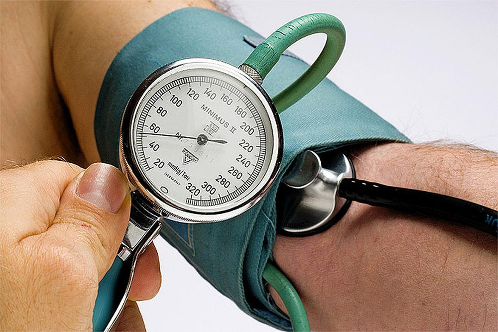 Стремительное падение артериального давления Стремительное падение артериального давления