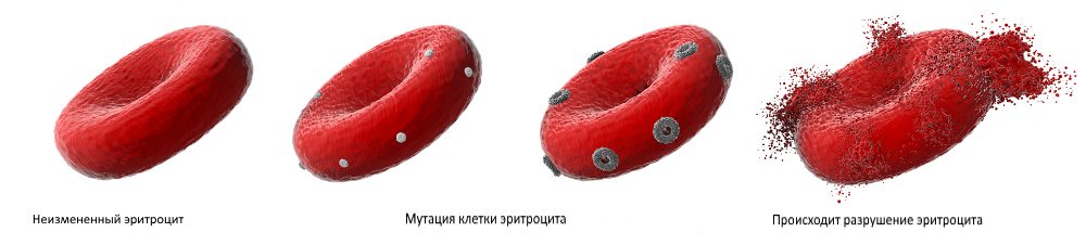Процесс разрушения эритроцита при ночной гемоглобинурии пароксизмальная ночная гемоглобинурия
