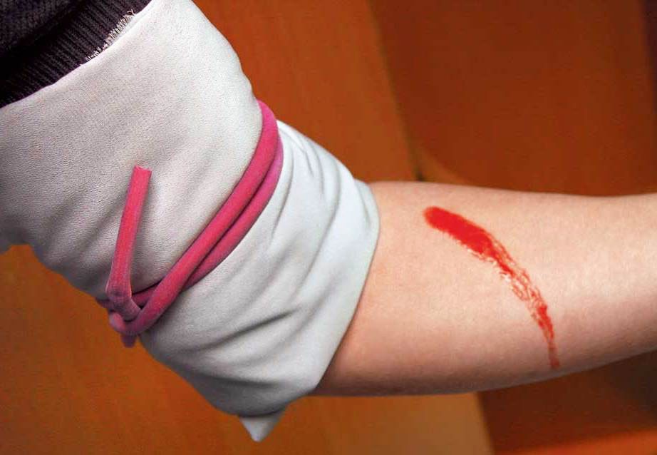 Перевязка руки жгутом Перевязка руки жгутом