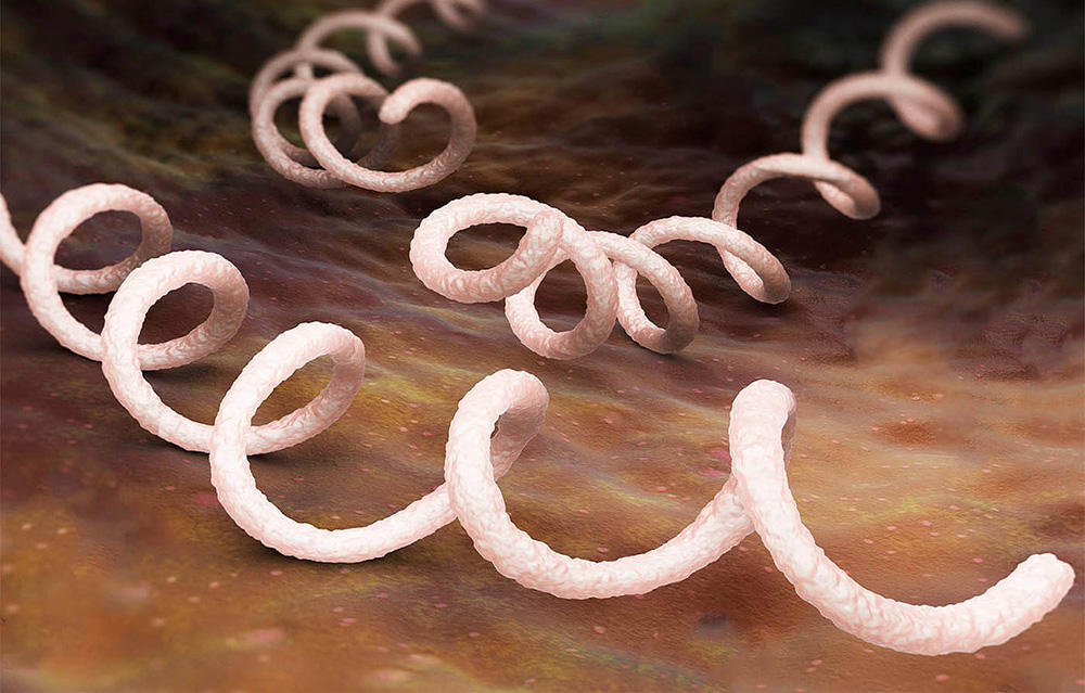 Причина сисфилиса бледная трепонема Причина сисфилиса бледная трепонема