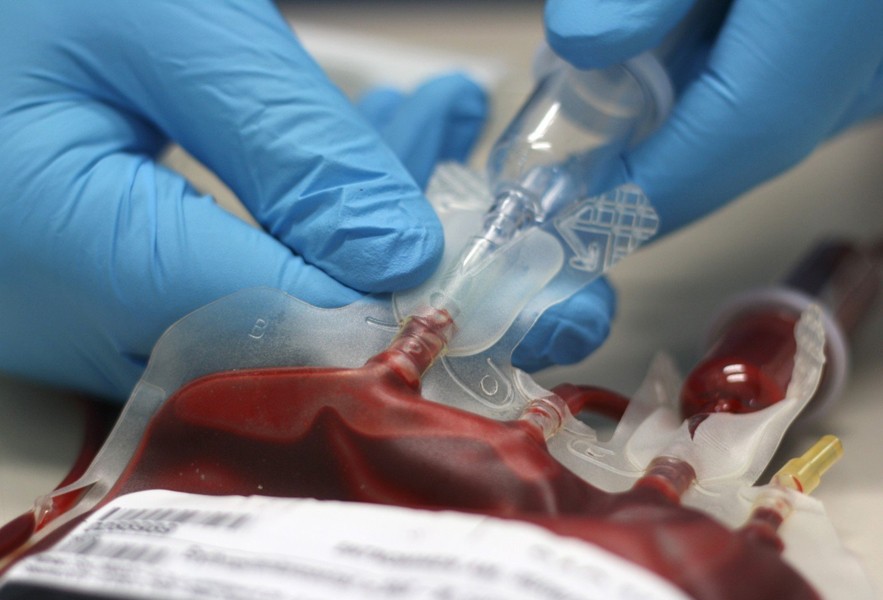 Применение трансфузии Применение трансфузии