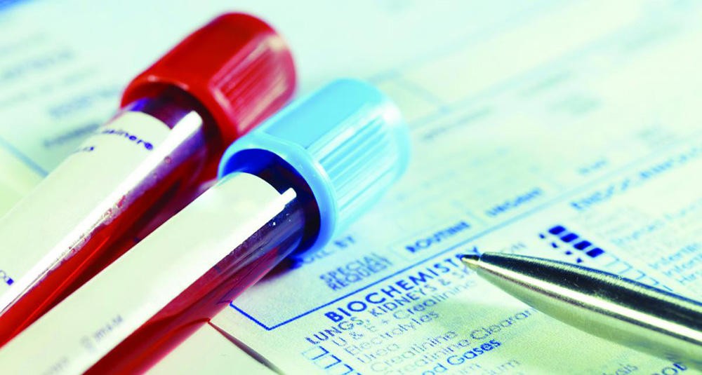 Вам пришел положительный результат Вам пришел положительный результат