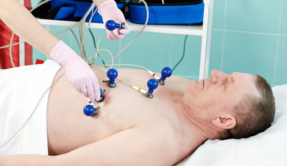 Прохождение электрокардиограммы у врача Прохождение электрокардиограммы у врача