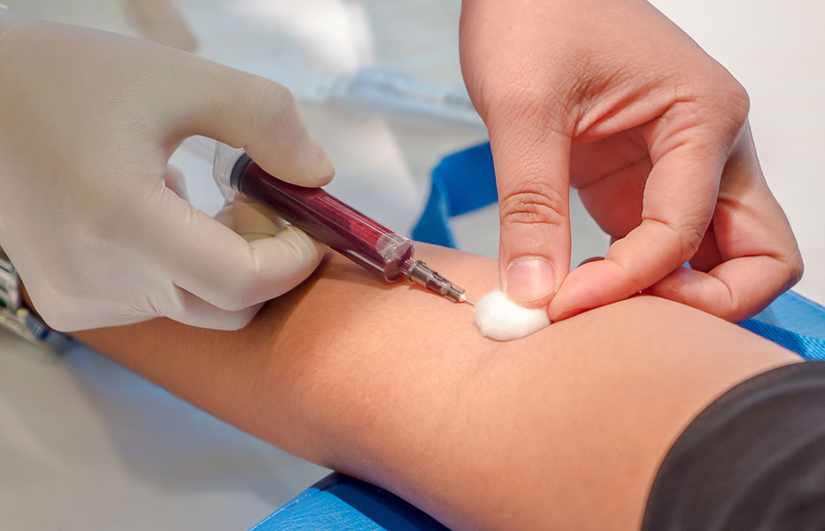 Сдача анализа крови на билирубин Сдача анализа крови на билирубин