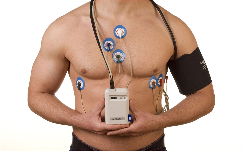 Суточный мониторинг ЭКГ Суточный мониторинг ЭКГ